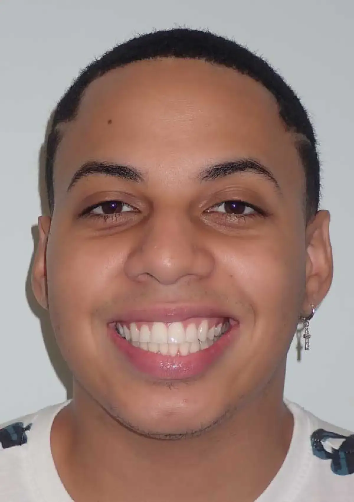 Ivan: portrait after treatment