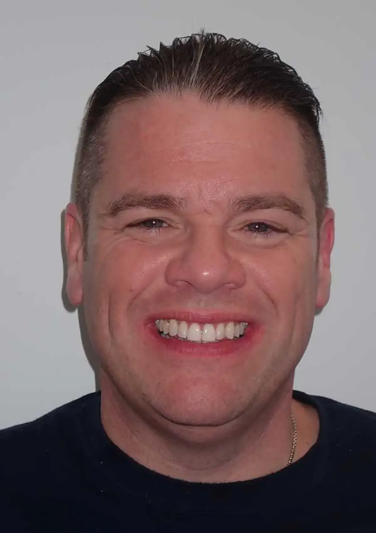 Patrick: portrait after treatment