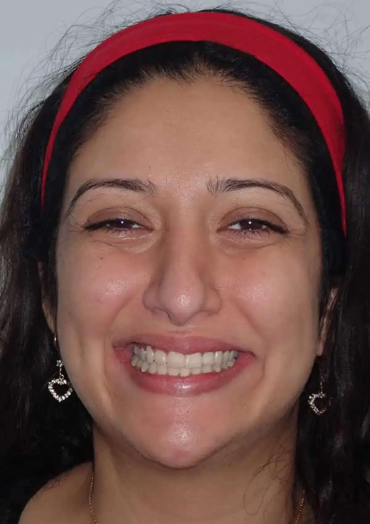Tamara: portrait after treatment