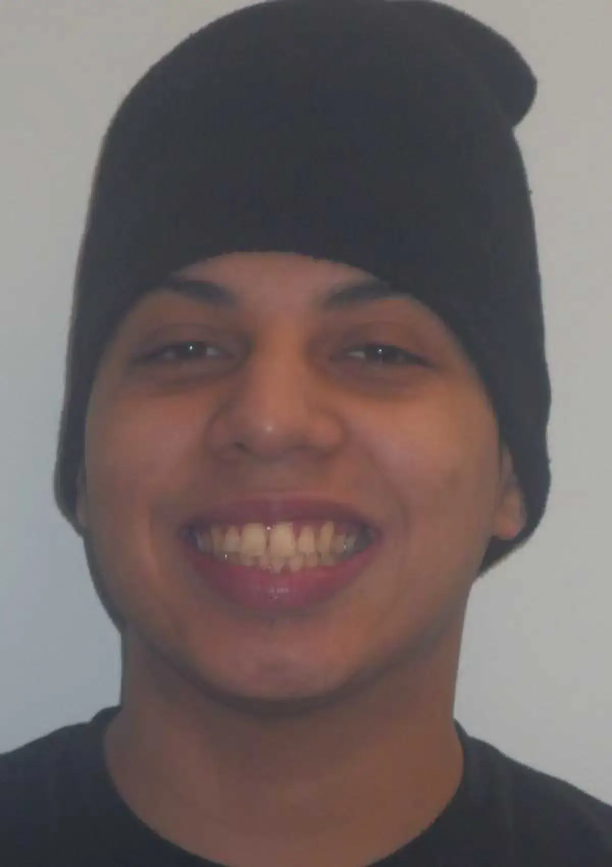 Ivan: portrait before treatment