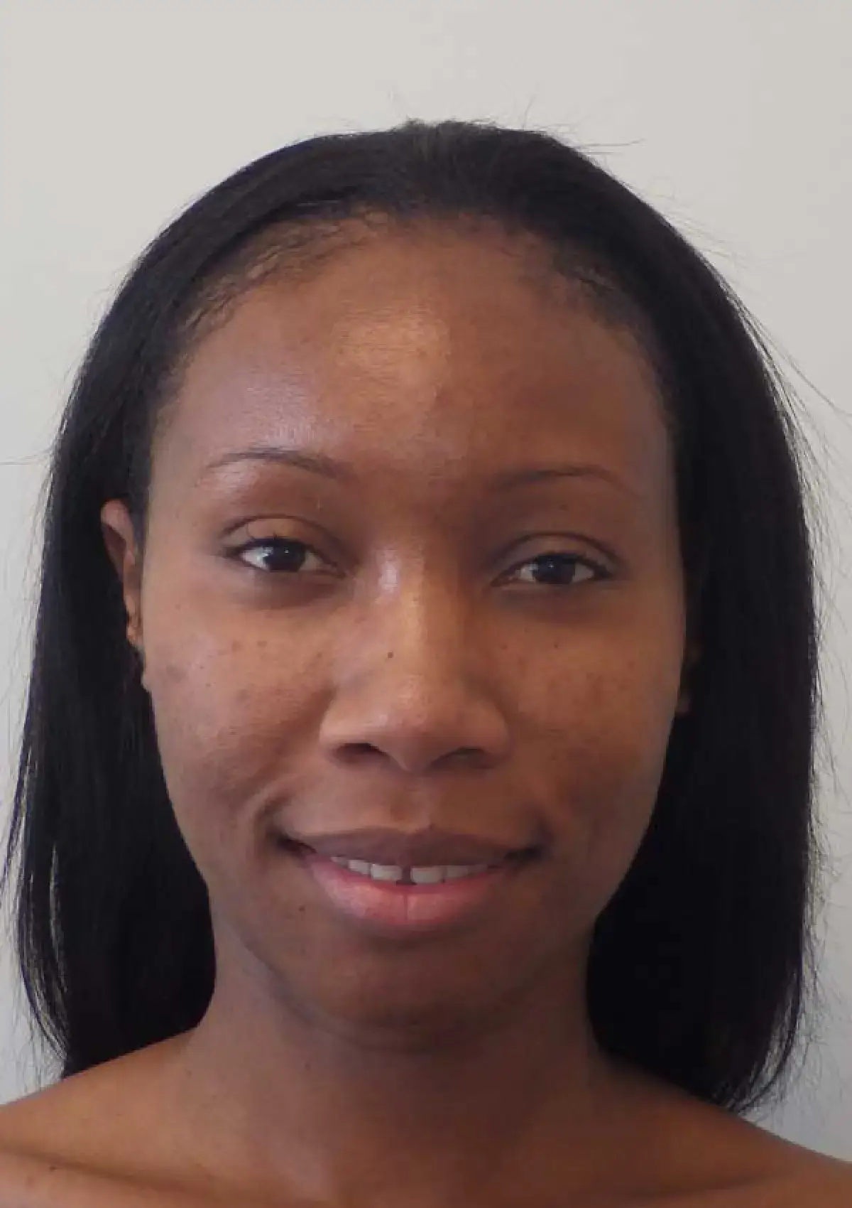 Nicola: portrait before treatment