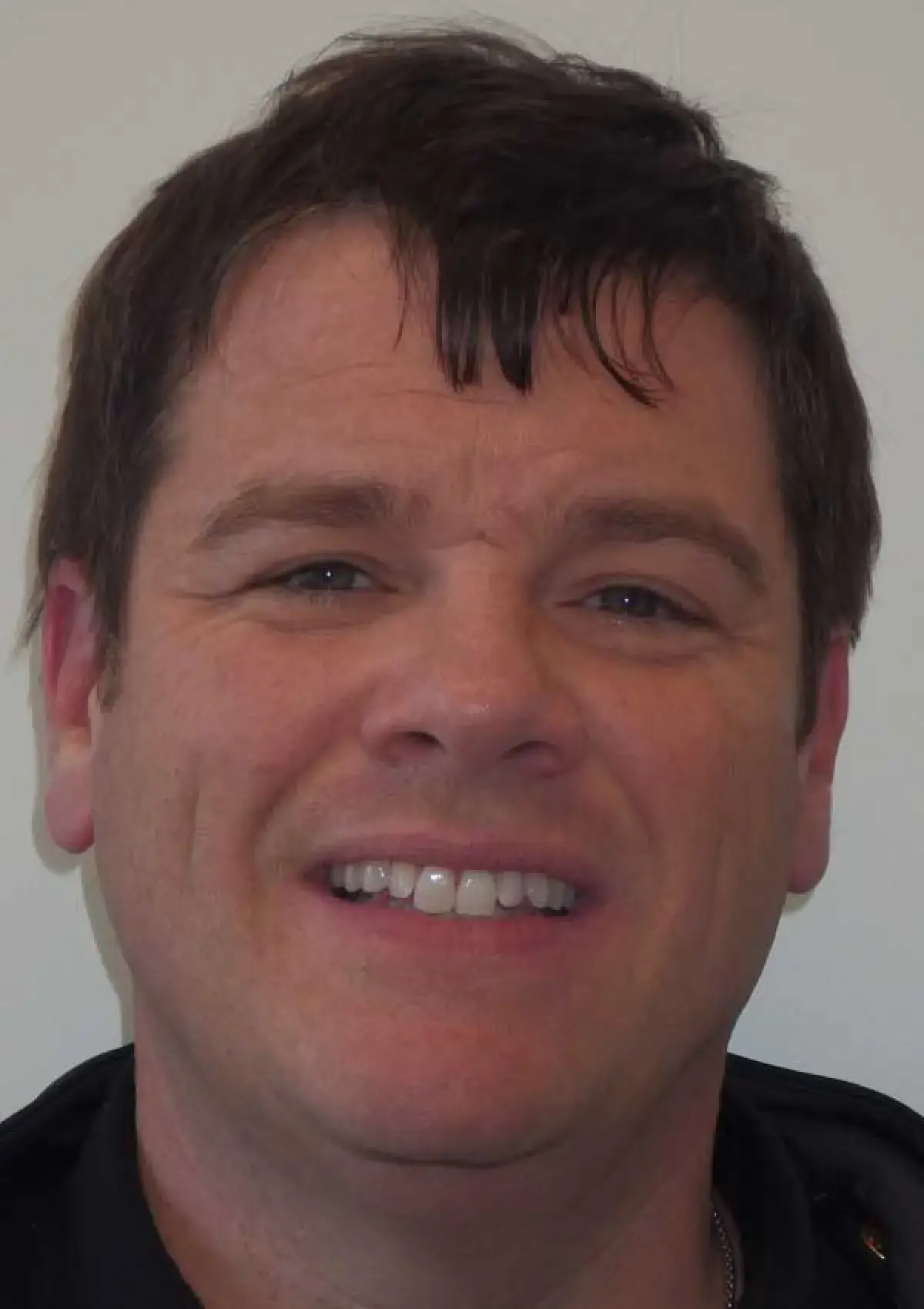 Patrick: portrait before treatment