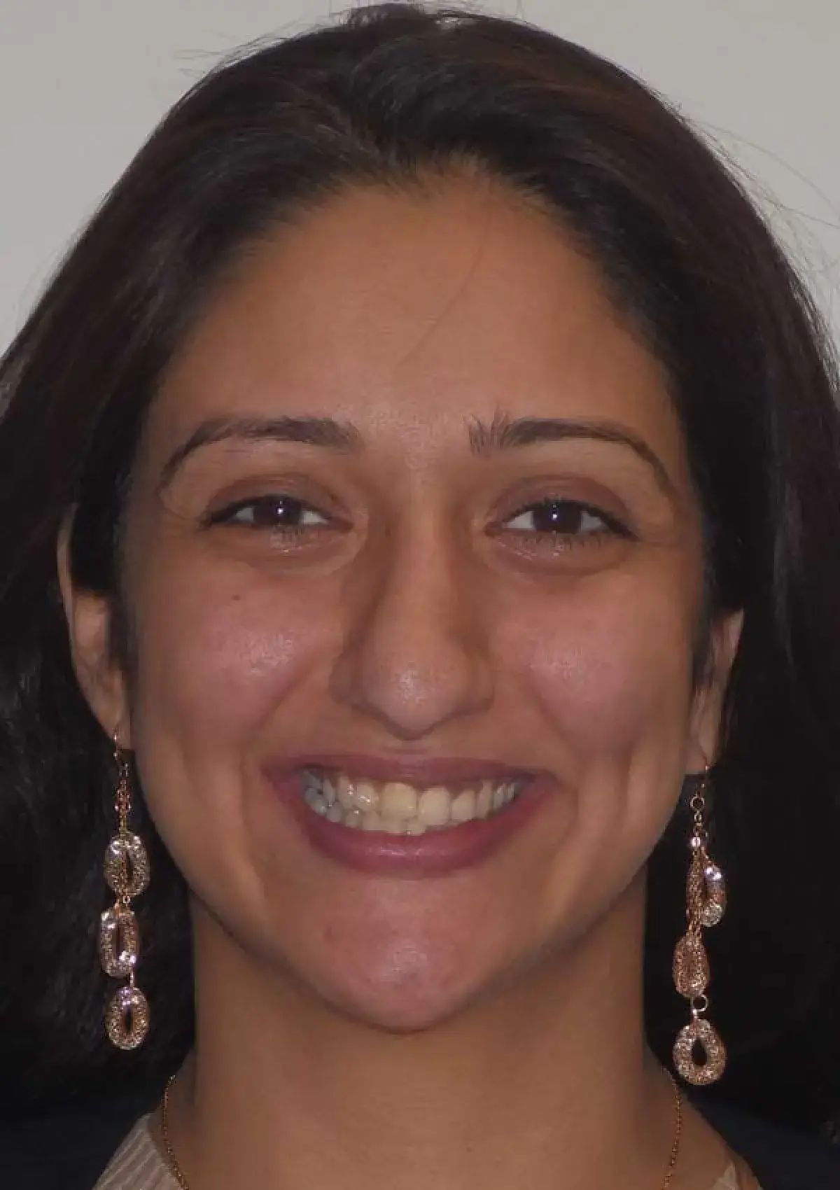 Tamara: portrait before treatment