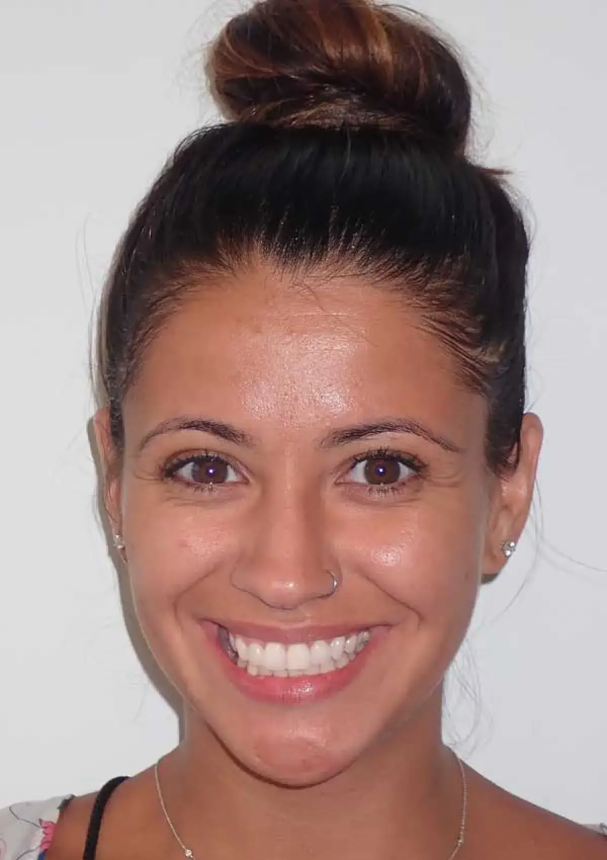 Ava: portrait before treatment