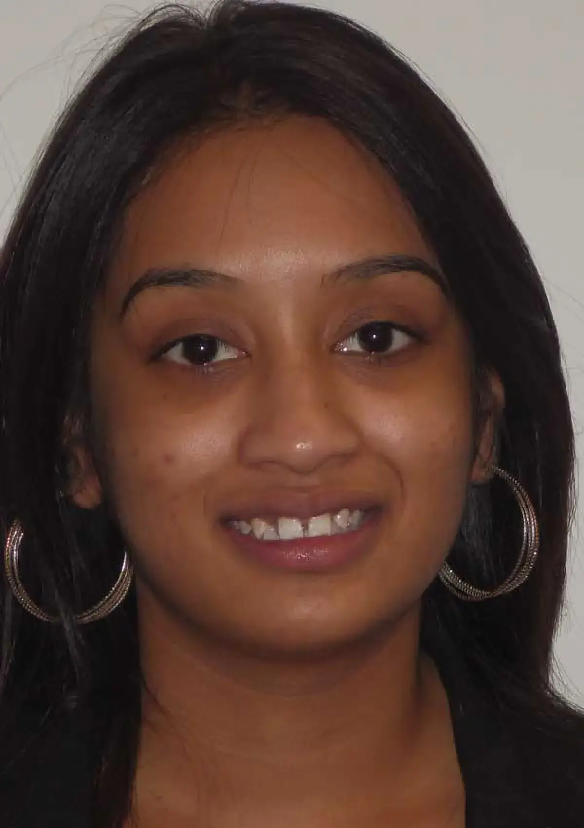Bhola: portrait before treatment