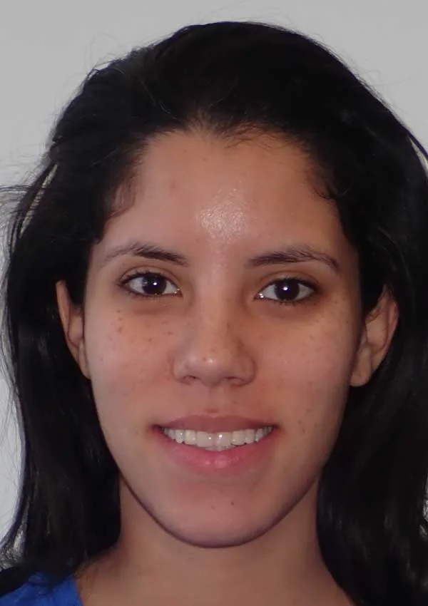 Karena: portrait after treatment